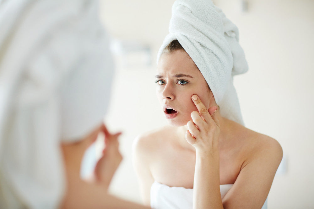 The Real Reason We Get Adult Acne + Easy, Natural Ways To Prevent It
